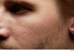 Face Cheek Hair Skin Man White Facial Bearded Studio photo references
